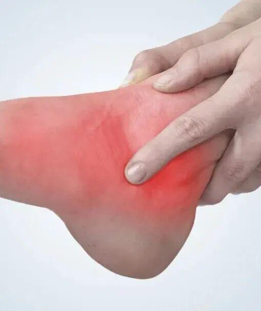  【技术深度】从分子机制到临床干预：痛风防治的系统性方法论 健康养生